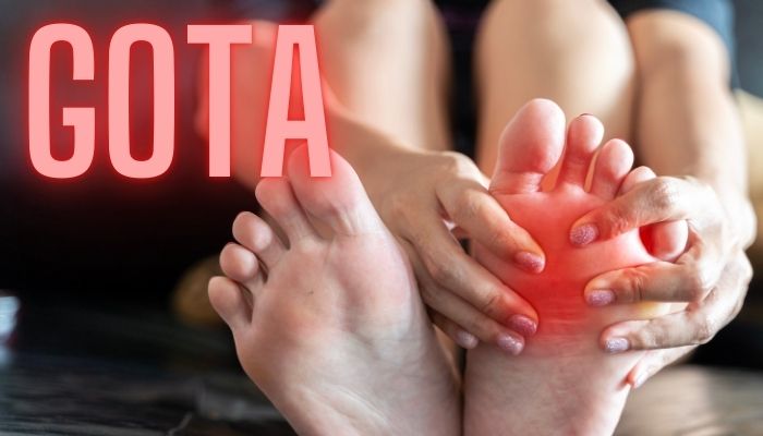 Os 5 Melhores Alimentos para Reduzir o Ácido Úrico gota - ácido úrico